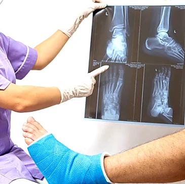 Fracture treatment recovery