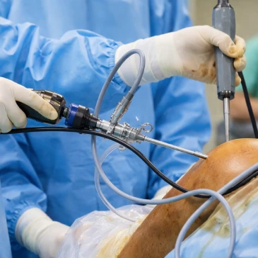 Keyhole arthroscopy procedure view