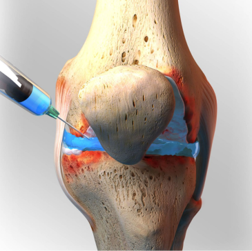 Stem cell therapy for knee joint care