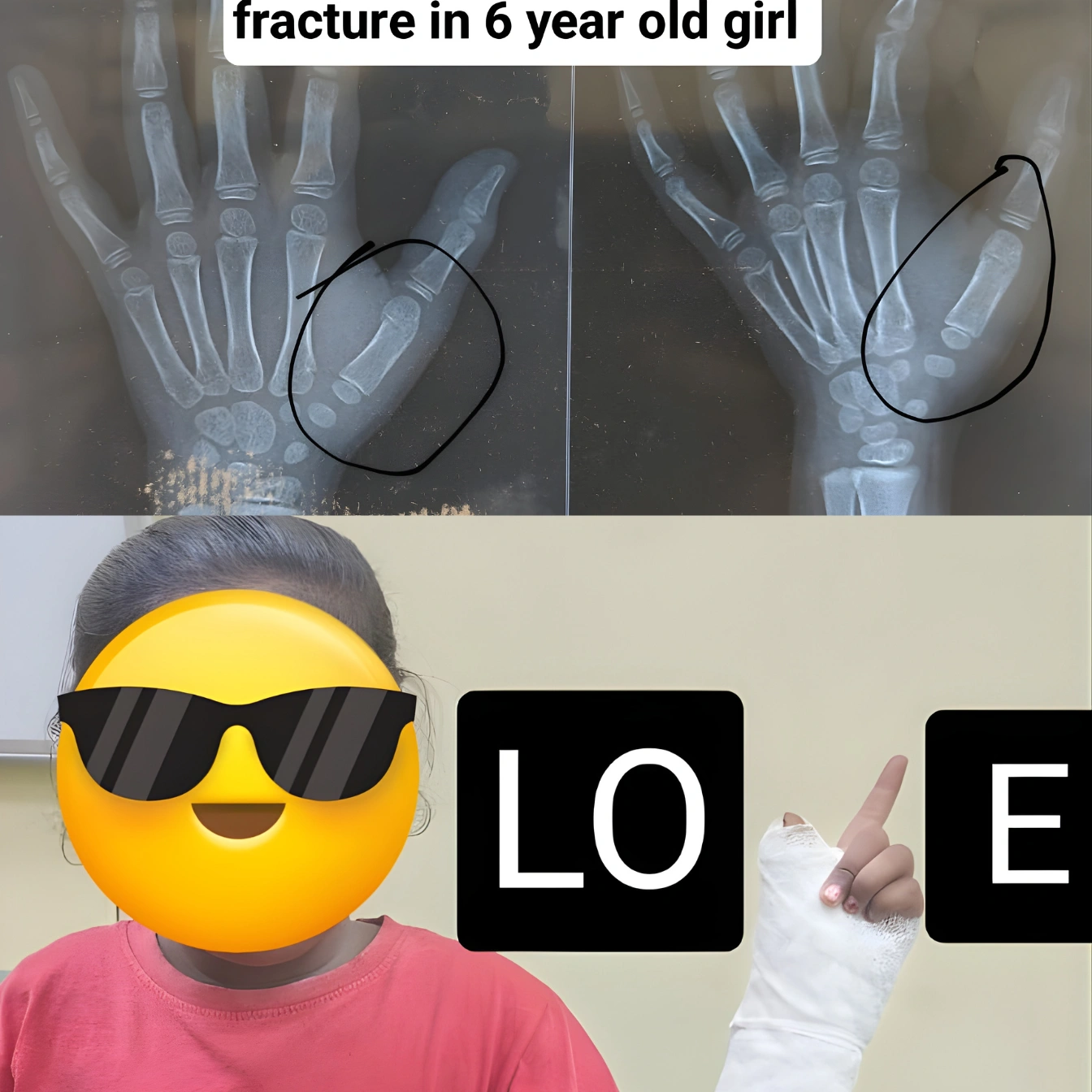 Pediatric Orthopedics